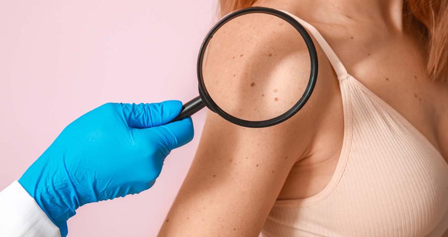 dermatologia a catania